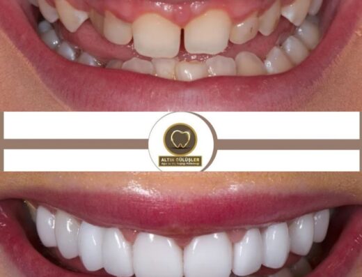 Golden Smile Dent